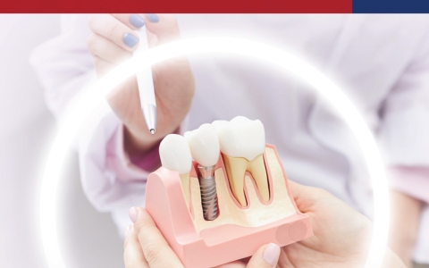 Dental implant