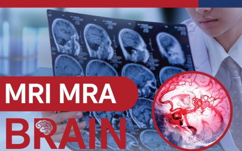 MRI MRA BRAIN การตรวจสมองและหลอดเลือดสมอง