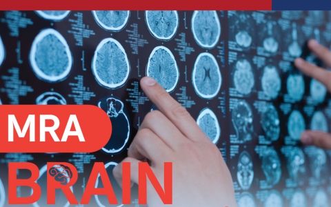 MRA BRAIN การตรวจหลอดเลือดสมองด้วยเครื่องสนามแม่เหล็กไฟฟ้า