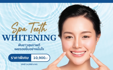 Spa Teeth Whitening