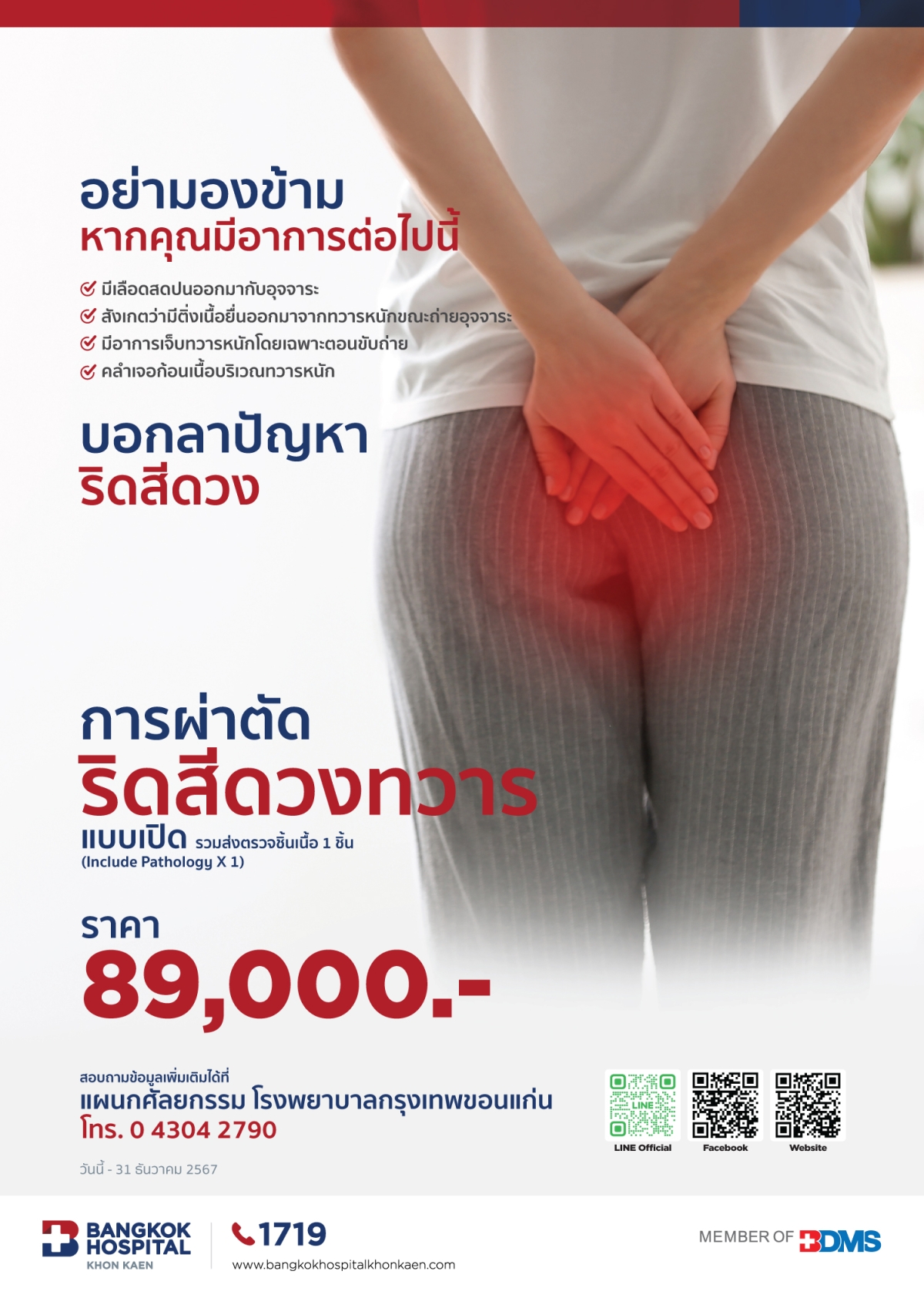 ริดสีดวงทวาร โดยวิธีการผ่านกล้องผ่าตัด Hemorrhoidectomy