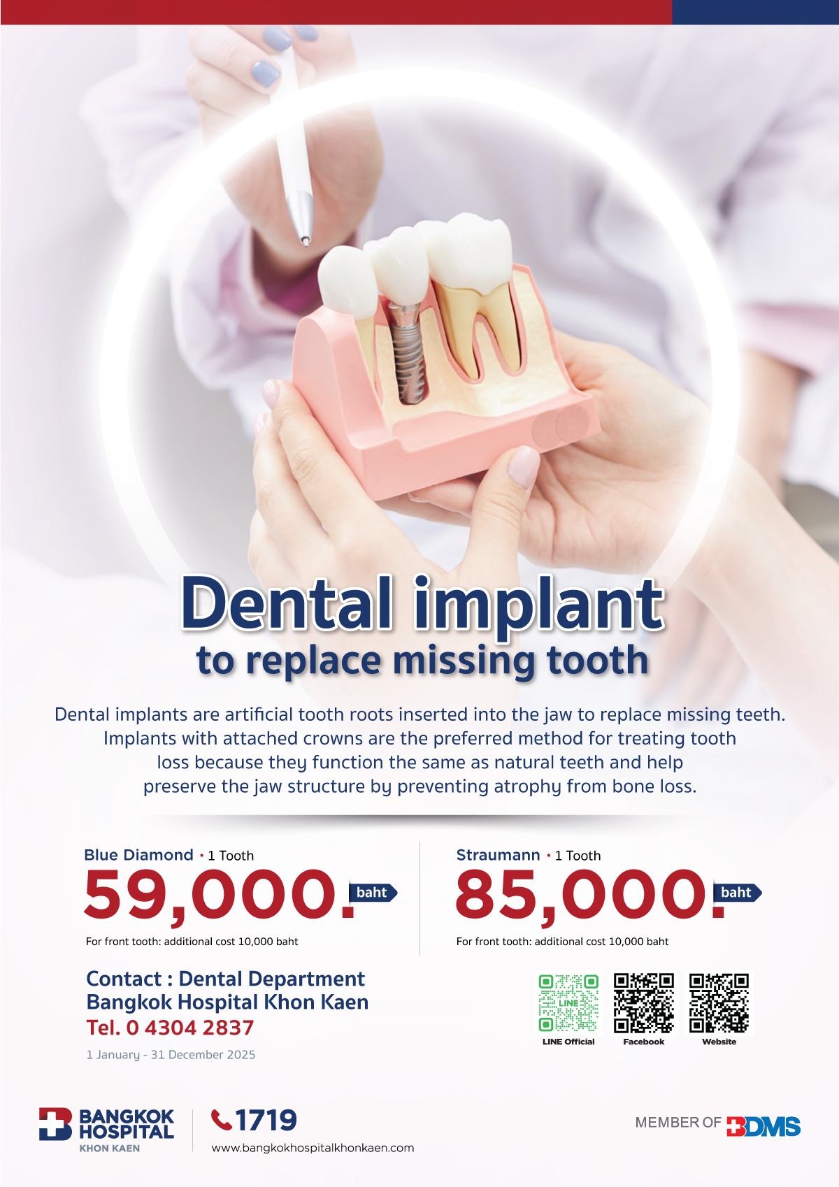 Dental implant